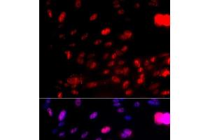 Immunofluorescence analysis of U2OS cells using Phospho-CHEK1(S317) Polyclonal Antibody (CHEK1 anticorps  (pSer317))