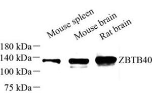 Western blot analysis of ZBTB40 (ABIN7076250) at dilution of 1: 250 (ZBTB40 anticorps)