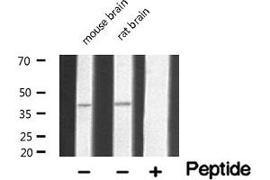 Western blot analysis of extracts of various tissue sample,using 5-HT-5A Antibody . (Serotonin Receptor 5A anticorps  (Internal Region))