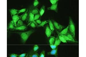 Immunofluorescence analysis of U2OS cells using KDM7A Polyclonal Antibody at dilution of 1:100. (JHDM1D anticorps)
