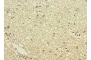 Immunohistochemistry of paraffin-embedded human brain tissue using ABIN7154932 at dilution of 1:100 (HHIP anticorps  (AA 18-220))
