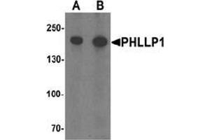 Western blot analysis of PHLPP1 in SW480 cell lysate with PHLPP1 Antibody  at (A) 1 and (B) 2 μg/ml. (PHLPP1 anticorps  (N-Term))