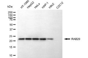 anti-RAB7, Member RAS Oncogene Family-Like 1 (RAB7L1) antibody
