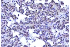 IHC analysis of RBM15B using anti-RBM15B antibody (ABIN7600219). (RBM15B anticorps  (AA 164-890))