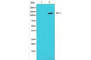 Western blot analysis on LOVO using HIF1a antibody ,The lane on the left is blocked with the antigen-specific peptide. (HIF1A anticorps  (Internal Region))