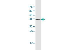 Western Blot detection against Immunogen (44.