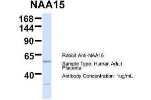 Host:  Rabbit  Target Name:  NAA15  Sample Type:  Human Adult Placenta  Antibody Dilution:  1. (NAA15 anticorps  (N-Term))
