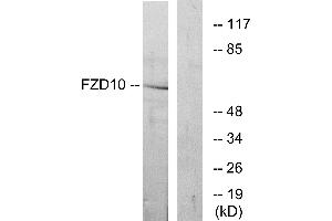 Western blot analysis of extracts from COS-7 cells, using FZD10 antibody. (FZD10 anticorps  (Internal Region))