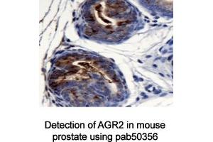 Image no. 1 for anti-Anterior Gradient Homolog 2 (Xenopus Laevis) (AGR2) (AA 1-50), (N-Term) antibody (ABIN363665) (AGR2 anticorps  (N-Term))