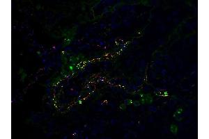 Co-expression of SARS-CoV-2 (COVID-19) Envelope and C5b-9 in Human Lung Tissue from the COVID-19 Patient: Immunofluorescent l analysis of paraffin-embedded COVID-19 patient lung tissue using anti- SARS-CoV-2 (COVID-19) Envelope antibody (ABIN1031551, 2 μg/mL, red) and anti-C5b-9 antibody (green). (SARS-CoV-2 Envelope anticorps  (N-Term))