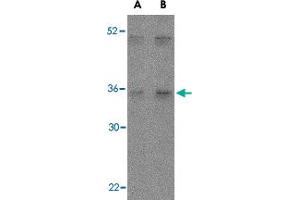 Western blot analysis of IL27 in Daudi lysate with IL27 polyclonal antibody  at (A) 2 and (B) 4 ug/mL . (IL-27 anticorps  (Internal Region))