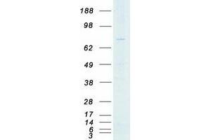 Validation with Western Blot