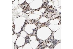 Immunohistochemical staining (Formalin-fixed paraffin-embedded sections) of human bone marrow with ZNF192 polyclonal antibody  shows strong nuclear positivity in bone marrow poietic cells. (ZNF192 anticorps)