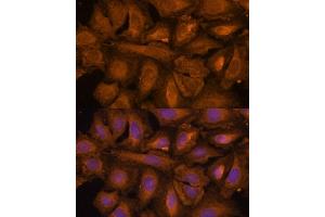 anti-STIP1 Homology and U-Box Containing Protein 1 (STUB1) (AA 1-303) antibody