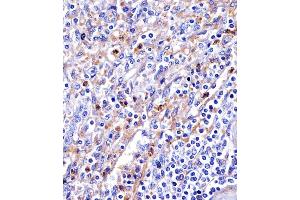 (ABIN6244292 and ABIN6578679) staining Transferrin in human spleen tissue sections by Immunohistochemistry (IHC-P - paraformaldehyde-fixed, paraffin-embedded sections). (Transferrin anticorps  (AA 432-466))