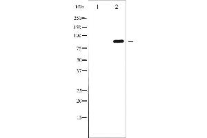 Western blot analysis of GluR2 phosphorylation expression in Mouse brain tissue lysates,The lane on the left is treated with the antigen-specific peptide.