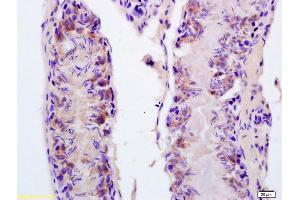 Formalin-fixed and paraffin embedded rat testis labeled with Anti-FASTKD5 Polyclonal Antibody, Unconjugated (ABIN873208) at 1:200 followed by conjugation to the secondary antibody and DAB staining