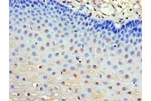 Immunohistochemistry of paraffin-embedded human esophagus tissue using ABIN7154506 at dilution of 1:100 (GRB7 anticorps  (AA 233-532))