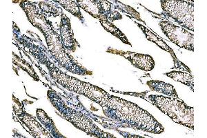 IHC analysis of Claudin18/CLDN18 using anti-Claudin18/CLDN18 antibody (ABIN7601257). (Claudin 18 anticorps  (AA 31-261))