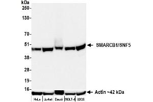 Western Blotting (WB) image for anti-SWI/SNF Related, Matrix Associated, Actin Dependent Regulator of Chromatin, Subfamily B, Member 1 (SMARCB1) (AA 100-150) antibody (ABIN7795715)
