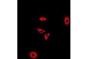 Immunofluorescent analysis of GLUD2 staining in A549 cells.