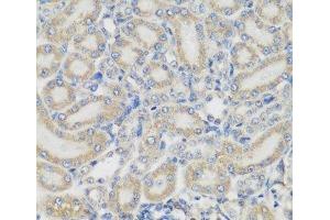 Immunohistochemistry of paraffin-embedded Rat kidney using PYCR1 Polyclonal Antibody at dilution of 1:200 (40x lens). (PYCR1 anticorps)
