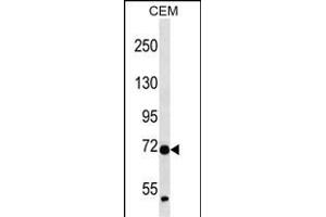 ZN Antibody (N-term ) (ABIN657252 and ABIN2837915) western blot analysis in CEM cell line lysates (35 μg/lane). (ZNF443 anticorps  (N-Term))