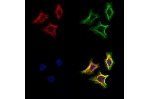 ABIN6265308 and ABIN6273168 staining Hela cells by IF/ICC. (Stanniocalcin 2 anticorps  (C-Term))