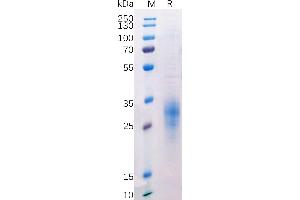 Human BTLA Protein, His Tag on SDS-PAGE under reducing condition.