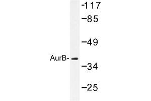 Image no. 1 for anti-Aurora Kinase B (AURKB) antibody (ABIN272108) (Aurora Kinase B anticorps)