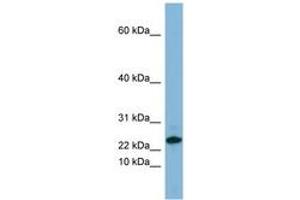 Image no. 1 for anti-Small Proline-Rich Protein 3 (SPRR3) (C-Term) antibody (ABIN6741688) (SPRR3 anticorps  (C-Term))