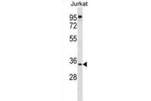 Western Blotting (WB) image for anti-UBX Domain Protein 8 (UBXN8) antibody (ABIN2998959)
