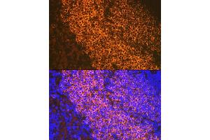 Immunofluorescence analysis of rat spleen using CD79B Rabbit mAb (ABIN1682474, ABIN3018855, ABIN3018856 and ABIN7101674) at dilution of 1:100 (40x lens).