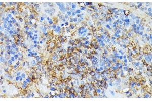 Immunohistochemistry of paraffin-embedded Rat spleen using COX15 Polyclonal Antibody at dilution of 1:100 (40x lens). (COX15 anticorps)