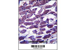 MYOM1 Antibody immunohistochemistry analysis in formalin fixed and paraffin embedded human skeletal muscle followed by peroxidase conjugation of the secondary antibody and DAB staining.
