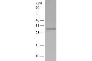 Western Blotting (WB) image for Ribosomal Protein, Large, P0 (RPLP0) (AA 2-317) protein (His-IF2DI Tag) (ABIN7124908)