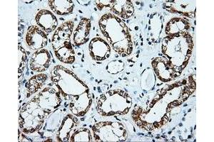 Immunohistochemical staining of paraffin-embedded Kidney tissue using anti-PLEK mouse monoclonal antibody. (Pleckstrin anticorps)