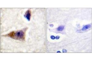 Immunohistochemistry analysis of paraffin-embedded human brain, using Caspase 1 (Phospho-Ser376) Antibody.