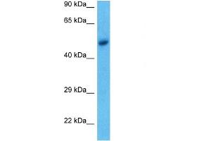 WB Suggested Anti-ACHA9 antibody Titration: 1 ug/mL Sample Type: Human MCF7 Whole Cell (CHRNA9 anticorps  (N-Term))