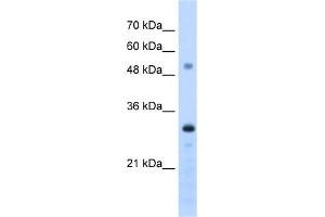 WB Suggested Anti-PSME3 Antibody Titration:  1.