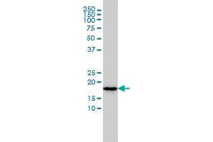 NAT5 monoclonal antibody (M01), clone 2C6 Western Blot analysis of NAT5 expression in HL-60 . (NAT5 anticorps  (AA 1-178))