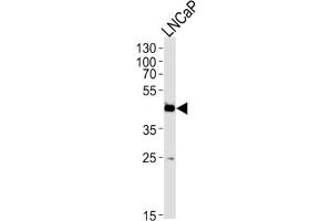 Western Blotting (WB) image for anti-Family with Sequence Similarity 54, Member A (FAM54A) antibody (ABIN3004761) (FAM54A anticorps)