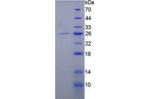 SDS-PAGE of Protein Standard from the Kit  (Highly purified E. (KRT8 Kit ELISA)