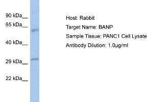 Host: Rabbit Target Name: BANP Sample Type: PANC1 Whole Cell lysates Antibody Dilution: 1. (BANP anticorps  (N-Term))