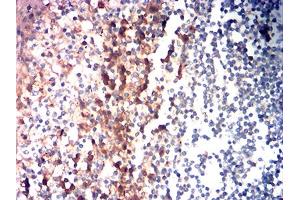 Immunohistochemical analysis of paraffin-embedded tonsil tissues using CD85G mouse mAb with DAB staining. (LILRA4 anticorps  (AA 24-178))
