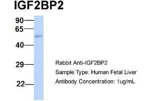 Host:  Rabbit  Target Name:  IGF2BP2  Sample Type:  Human Fetal Liver  Antibody Dilution:  1. (IGF2BP2 anticorps  (Middle Region))