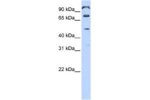 WB Suggested Anti-C10orf38 Antibody Titration:  0. (FAM171A1 anticorps  (Middle Region))