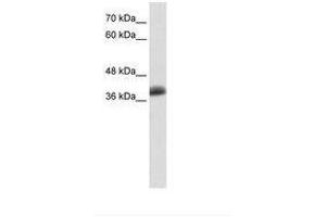 Image no. 1 for anti-SAP30 Binding Protein (SAP30BP) (AA 191-240) antibody (ABIN6736132) (SAP30BP anticorps  (AA 191-240))