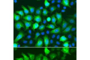 Immunofluorescence analysis of A549 cells using RRM2 Polyclonal Antibody (RRM2 anticorps)