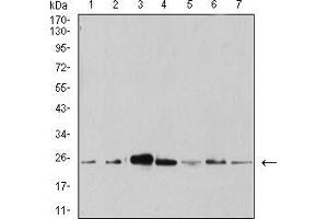 Western blot analysis using ANAPC10 mouse mAb against Hela (1), MCF-7 (2), SK-Br-3 (3), A431 (4), HEK293 (5), A549 (6), and SPC-A-1 (7) cell lysate. (ANAPC10 anticorps  (AA 1-185))